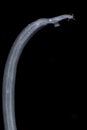 Schistosoma is a genus of trematodes, commonly known as blood flukes.