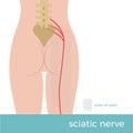 Sciatic nerve anatomy vector format illustration Royalty Free Stock Photo