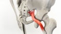 Sciatic Pinched Nerve Illustration Royalty Free Stock Photo