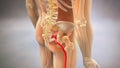 Sciatic Pinched Nerve 3D Render Royalty Free Stock Photo