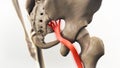 Sciatic Pinched Nerve Illustration