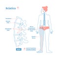 Sciatica medical health care vector illustration diagram scheme with lower spine and sciatic nerve pain in leg.