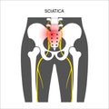 Muscular pelvis concept