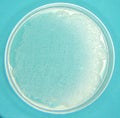 Petri Dish with Ecoli Culture growing