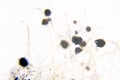 Microscope photography of Aspergillus
