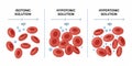Red cells in isotonic hypotonic and hypertonic solutions 1 Royalty Free Stock Photo