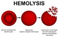 Scientific diagram and process of hemolysis Royalty Free Stock Photo