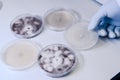 Scientific handling Microbiological cultures in a petri dish for pharmaceutical bioscience research. Concept of science,