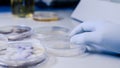 Scientific handling Microbiological cultures in a petri dish for pharmaceutical bioscience research. Concept of science,
