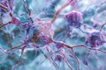 Neurons with dendrites affected by amyloid plaques in Alzheimer\'s disease. Generative AI