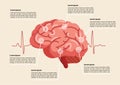 Human brain stroke illustration