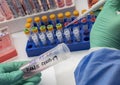 Scientist investigates in a vial new covid-19 virus variant from Brazil detected