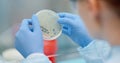 Scientist looking at bacteries in petri dish at laboratory