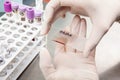 Scientist preparing a bone marrow smear in the laboratory. Blood smear