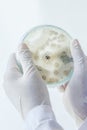 Scientist show colony of fungus Royalty Free Stock Photo