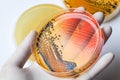 Scientist's hand in latex glove holding the bacteria growing pet