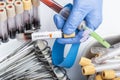 Scientists hand holding a test-tube with blood sample for LEGIONELLA test.