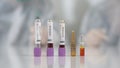 Scientists test lab rat, mouse with syringe. Scientist and lab rat Back ground. Coronavrius test tubes. Covid-19 vaccine. Royalty Free Stock Photo