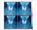 Scintigraphy of thyroid gland with two nodule