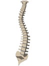 Scoliosis