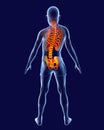 Scoliosis, 3D illustration. Spine curve anatomy Royalty Free Stock Photo