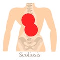 Scoliosis icon, cartoon style