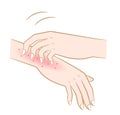 Scratching the itch hands redness rash. dry skin, eczema,dermatitis, scabies, burns, scars, rash, insect bites and hives. Healthy