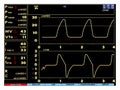 Screen, monitor with signs of the artificial lung ventilation device in a realistic design. Isolated vector