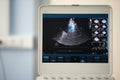 Photo of the screen of an ultrasound scanner with the image of a