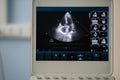 The screen of an ultrasound device with the image of four chambers of the heart.