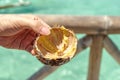 Sea urchins on the hand