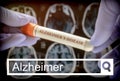 Search in the Alzheimer network, Scientist holds blood sample to investigate remedy against Alzheimer`s disease