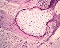 Sebaceous gland. Arrector pili