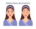 Seborrheic dermatitis. Isolated Beautiful Brunette woman. Cute face. Skin disease. Cartoon style Royalty Free Stock Photo