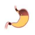 The second phase of digestion that follows mastication and takes place in the stomach.