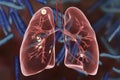 Secondary tuberculosis in lungs