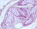 Sweat gland. Secretory unit. Mallory PTAH stain