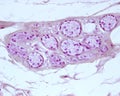 Sweat gland. Secretory unit. Mallory PTAH stain