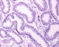 Apocrine sweat gland. Secretory unit Royalty Free Stock Photo