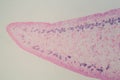 Section of a common liver fluke Fasciola under the microscope