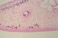 Section of a common liver fluke Fasciola under the microscope