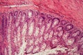 Section of a dog ciliated epithelium