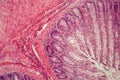 Section of a dog ciliated epithelium