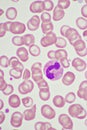 Segmented neutrophil cell in human blood smear