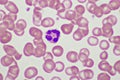 Segmented neutrophil cell in human blood smear