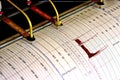 Seismograph for drilling