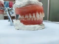 Selective focus on artificial teeths or denture fitted in atrticulater with a blur background