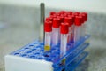 Selective focus on blood test tubes in a lab put to analysis Royalty Free Stock Photo