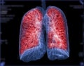 Selective focus of CT Chest or Lung 3D rendering image on the monitor for diagnosis TB,tuberculosis and covid-19