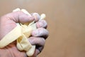 human hand with cornstarch powder clinging skin from worn medical powdered latex gloves causing allergy and hypersensitivity